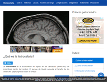 Tablet Screenshot of hidrocefalia.net